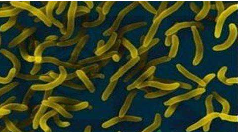 微生物菌劑好？好在哪里您知道嗎？